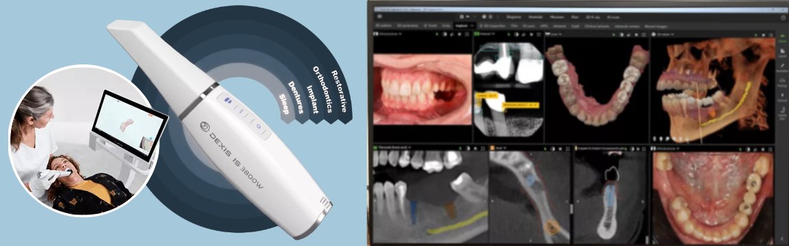 DEXIS™ 3D dental imaging technology
