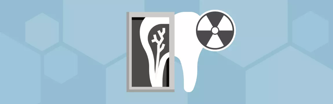 Dental X-Rays